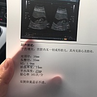 这是男孩还是女孩啊