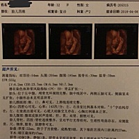 今天的四维彩超，顺利通过，大家猜一下男宝，女宝！已知！