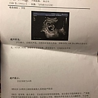 大家帮我看看，实在想知道男女