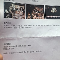 宝妈，帮助看看是男宝还是女宝