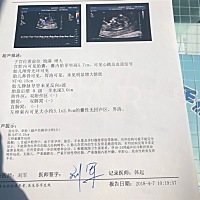 调皮的宝宝，竟然还挑大夫，做了三次，好在nt在第三次的时候顺利通过啦