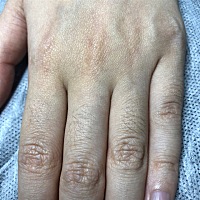 本来体毛就很重，看到身边嫂子姐姐怀孕后体毛更重了，就很害怕，怕自己变成大猩猩🦍，哈哈哈哈。但是...