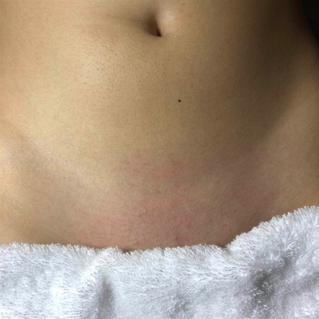 第一次尝试私处全脱 超赞的啊