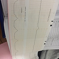 这两张是今天做的……37周…胎监…第一张没通过…………就是不知道为什么胎监没通过，