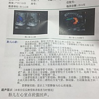 有没有会看的，帮忙看看是男宝还是女宝？