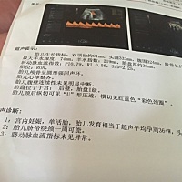 昨天做B超正常啊…只是做胎监没通过………到了晚上有一边鼻塞，发现宝宝少动了……怎么回事啊