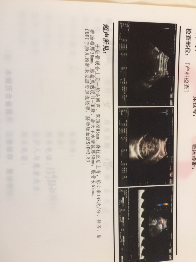 有经验的宝妈能看出男孩女孩吗☺️