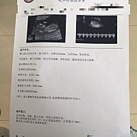 nt顺利通过✌️