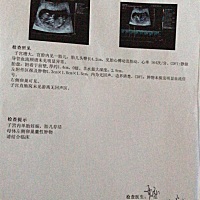 这个能看出是男是女吗