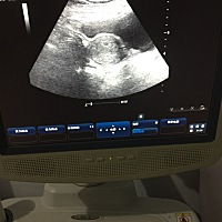 你离开半年多了。很怪自己当时身体为什么那么脆弱。现在想好好弥补想怀孕了。确怀不上了。可能这是你对...