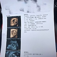 看得出是男是女吗？还有第二张长长的是脐带还是腿呢？好期待