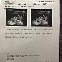 宝妈们谁会看NT单子？帮忙看下男宝女宝？