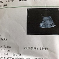 睡得像个大爷一样，看了好久不知道ta头在哪儿呢，以为会长得不好，医生就说低置胎盘，其他挺好！但愿你...
