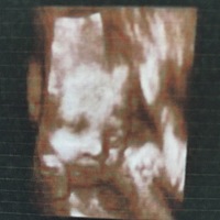 猜猜看男孩女孩