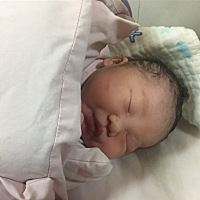 刨宫产，8斤二两的大白胖小子
