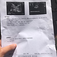 有一样经历的宝妈吗？今天nt检查