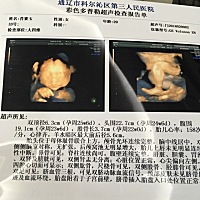 四维顺利通过，图二看起来像男宝，我想要个女宝😢