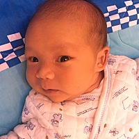 宝宝现在20天了，腿上都有一层皮没掉，一般多久会脱皮完变白，脸上黄疸也还没有完全褪去