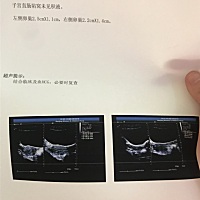 停经50天，三天前hcg只有九百多，今天抽血结果还没出来，刚才b超啥也看不见是怎么回事，求看