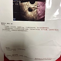 有谁看的懂吗？是不是正常的，医生也没有说什么？