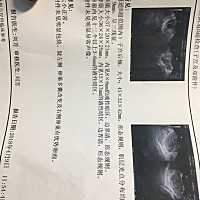 各位可爱的小姐姐们，多囊改变是什么意思呀，右侧有优质卵泡我是不是可以准备同房啦！