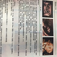 你们有会看男女宝宝的吗，今天四维检查说营养不良，要补充营养，你们知道吃什么补充营养吗