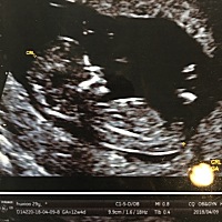 nt过来。检查的时候紧张shi我了。希望之后也能一样顺利。