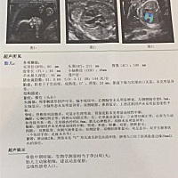 亲们，帮忙看下男女😄