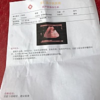 现在刚好八周，不出血也不腹痛，能吃能睡，b超医生说胎儿发育不良，孕酮偏低，开了黄体酮和安胎灵吃，希...