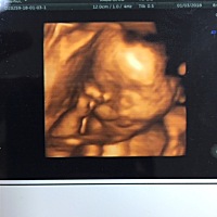 小胖子马上要出来了，等出生后再发个帖子对比一下看看跟四维差多少哈哈。