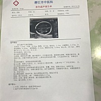 今天检查了，这个调皮的小家伙一直趴着不配合，下午才好呢～       希望下次检查也一切顺利。宝宝能健康...