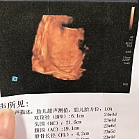 五官都这么清楚了！不过不像我！不知道会不会是个女宝宝！期待啊！