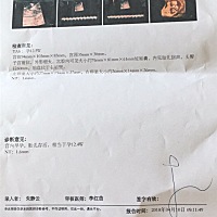 今天刚做的nt，可以看的出来胎儿大不大吗？