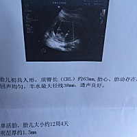 能看出男孩女孩吗？