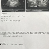 哈哈哈、、、各位大神能看出男女吗？好期待