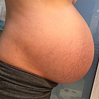 宝妈们你们都是什么时候卸货的分别是剖腹产还是顺产？在线等