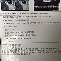 各位大神，帮忙看看是男宝还是女宝啊