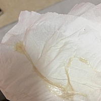 这是见红吗 孕晚期了