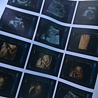 前几天做的四维，二胎了，第一胎是个女宝宝，请问谁看的懂这个是男宝女宝。