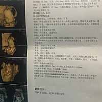 今天做四维顺利通过啦～～～～会看男女的孕妈来帮我看看哈