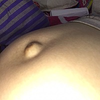 目前33周，一到晚上或者饭吃饱，肚挤眼就凸出来了，这是啥情况？也没查过男孩女孩～