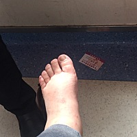 住院了，妊高症妊娠糖尿病心脏也不对，医生让最迟周五刨腹产，正好34周，宝宝得进保温箱，
