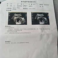 孕酮低。彩超没事。应该没什么事吧。