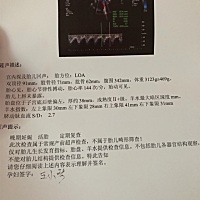 孕38周。医生说胎儿缺氧不知道是羊水少还是干嘛。希望看懂单子的宝妈们说说羊水指数正常嘛