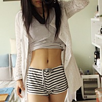 宫外孕保守治疗失败，转了微创手术。从此肚子都有伤口了（图片是术前）