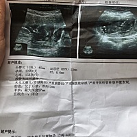 13周加2天去做的NT.找的熟人问是男是女。说看不清楚，谁知道看下是什么