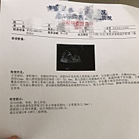 帮我看看小枣子是男是女啊？纯粹好奇