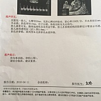 今天做NT顺利通过 希望所有孕妇检查都顺顺利利通过 可以看是男宝宝还是女宝宝不 就是好奇