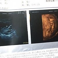 NT顺利通过 好开心 有没有宝妈看的出是男宝还是女宝