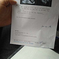 今天做的nt检查，有懂的可以帮我看一下男女么？